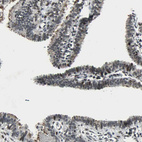 Immunohistochemical staining of human fallopian tube shows moderate nuclear positivity in a subset of glandular cells.