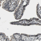 Anti-TAF6 Antibody