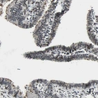 Immunohistochemical staining of human fallopian tube shows moderate nuclear positivity in a subset of glandular cells.