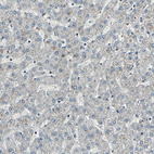 Immunohistochemical staining of human liver shows no positivity in hepatocytes as expected.
