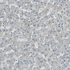 Immunohistochemical staining of human liver shows no positivity in hepatocytes as expected.