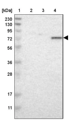 Lane 1: Marker [kDa] 230, 130, 95, 72, 56, 36, 28, 17, 11_br/_Lane 2: Human cell line RT-4_br/_Lane 3: Human cell line U-251MG sp_br/_Lane 4: Human plasma (IgG/HSA depleted)