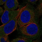 Anti-LIPE Antibody