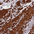 Immunohistochemical staining of human prostate shows strong cytoplasmic positivity in smooth muscle cells.