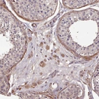 Immunohistochemical staining of human testis shows moderate cytoplasmic positivity in Leydig cells.
