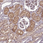 Immunohistochemical staining of human kidney shows moderate cytoplasmic positivity in cells in tubules.