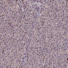 Anti-NLRC4 Antibody