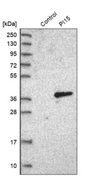 Anti-PI15 Antibody