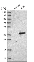 Western blot analysis in control (vector only transfected HEK293T lysate) and PI15 over-expression lysate (Co-expressed with a C-terminal myc-DDK tag (~3.1 kDa) in mammalian HEK293T cells, LY414340).