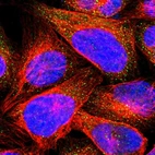 Immunofluorescent staining of human cell line U-2 OS shows localization to vesicles.