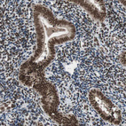 Anti-CHAMP1 Antibody