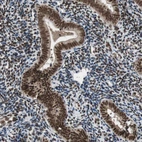 Immunohistochemical staining of human endometrium shows strong nuclear positivity in glandular cells and endometrial stromal cells.