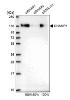 Western blot analysis in U2OS cells transfected with control siRNA, target specific siRNA probe #1 and #2, using Anti-CHAMP1 antibody. Remaining relative intensity is presented.