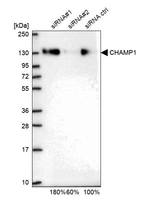 Western blot analysis in U2OS cells transfected with control siRNA, target specific siRNA probe #1 and #2, using Anti-CHAMP1 antibody. Remaining relative intensity is presented.