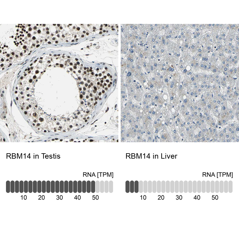 Anti-RBM14 Antibody