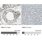 Anti-RBM14 Antibody