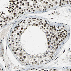 Immunohistochemical staining of human testis shows strong nuclear positivity in cells in seminiferous ducts.