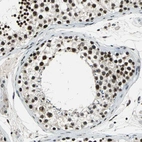 Immunohistochemical staining of human testis shows strong nuclear positivity in cells in seminiferous ducts.
