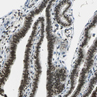 Immunohistochemical staining of human Fallopian tube shows strong nuclear positivity in glandular cells.
