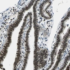 Immunohistochemical staining of human Fallopian tube shows strong nuclear positivity in glandular cells.