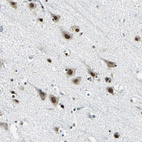 Immunohistochemical staining of human cerebral cortex shows moderate nuclear positivity in neurons.
