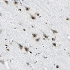 Immunohistochemical staining of human cerebral cortex shows moderate nuclear positivity in neurons.
