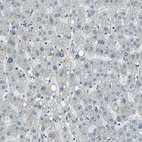 Immunohistochemical staining of human liver shows no positivity in hepatocytes as expected.