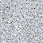 Immunohistochemical staining of human liver shows no positivity in hepatocytes as expected.
