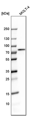 Western blot analysis in human cell line MOLT-4.