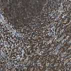 Anti-PSME1 Antibody