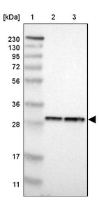 Lane 1: Marker [kDa] 230, 130, 95, 72, 56, 36, 28, 17, 11_br/_Lane 2: Human cell line RT-4_br/_Lane 3: Human cell line U-251MG sp