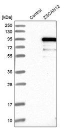 Western blot analysis in control (vector only transfected HEK293T lysate) and ZSCAN12 over-expression lysate (Co-expressed with a C-terminal myc-DDK tag (~3.1 kDa) in mammalian HEK293T cells, LY422096).