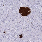 Immunohistochemical staining of human pancreas shows strong cytoplasmic and nuclear positivity in islets of Langerhans.