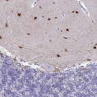 Immunohistochemical staining of human cerebellum shows strong nuclear positivity in cells in molecular layer.