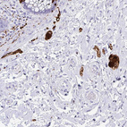 Anti-SCGN Antibody