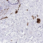 Immunohistochemical staining of human rectum shows strong cytoplasmic positivity in peripheral nerve / ganglion.