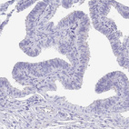 Anti-SCGN Antibody