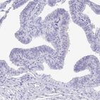 Immunohistochemical staining of human Fallopian tube shows no positivity in glandular cells as expected.