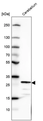 Western blot analysis in human cerebellum tissue.