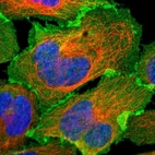 Immunofluorescent staining of human cell line U-2 OS shows localization to plasma membrane & cell junctions.