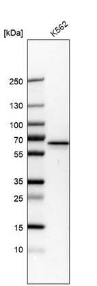 Anti-PKLR Antibody