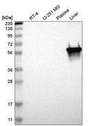 Western blot analysis in human cell line RT-4, human cell line U-251 MG, human plasma and human liver tissue.