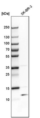 Western blot analysis in human cell line SK-BR-3.