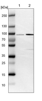 Lane 1: NIH-3T3 cell lysate (Mouse embryonic fibroblast cells)_br/_Lane 2: NBT-II cell lysate (Rat Wistar bladder tumour cells)