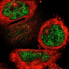 Immunofluorescent staining of human cell line A-431 shows localization to nucleoplasm.