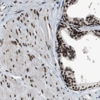Immunohistochemical staining of human prostate shows strong positivity in nuclear membrane in smooth muscle cells and glandular cells.