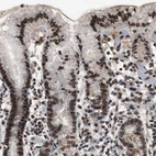 Immunohistochemical staining of human stomach shows strong positivity in nuclear membrane in glandular cells.