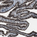 Immunohistochemical staining of human fallopian tube shows moderate positivity in nuclear membrane in glandular cells.