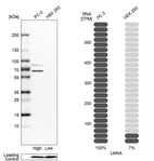 Western blot analysis in human cell lines PC-3 and HEK293 using Anti-LMNA antibody. Corresponding LMNA RNA-seq data are presented for the same cell lines. Loading control: Anti-PFN1.