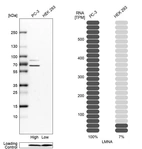 Western blot analysis in human cell lines PC-3 and HEK293 using Anti-LMNA antibody. Corresponding LMNA RNA-seq data are presented for the same cell lines. Loading control: Anti-PFN1.